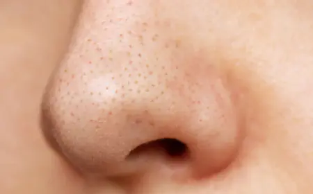 Khwab mein Naak Dekhna Ki Tabeer in Urdu