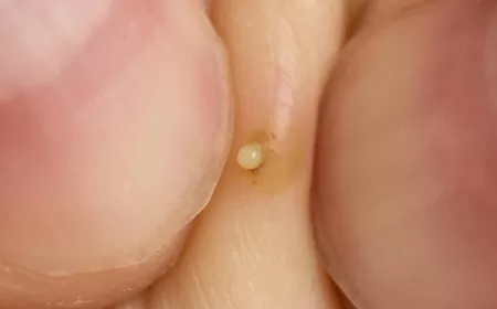 Khwab mein Peep Dekhna Ki Tabeer in Urdu